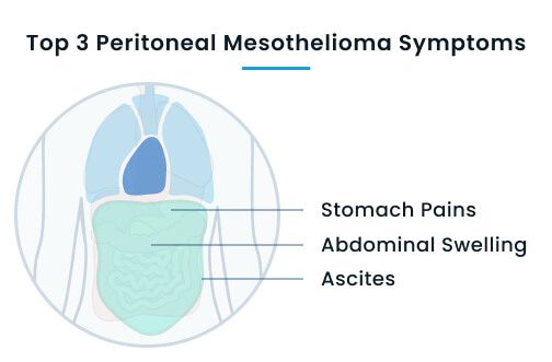 does oxygen help mesothelioma