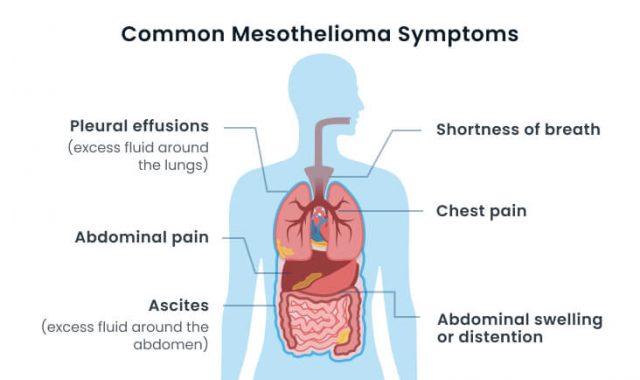 Mesothelioma Cancer Symptoms And Early Warning Signs